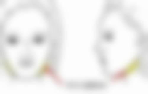 注射填充治疗能去除下眼袋皱纹吗？