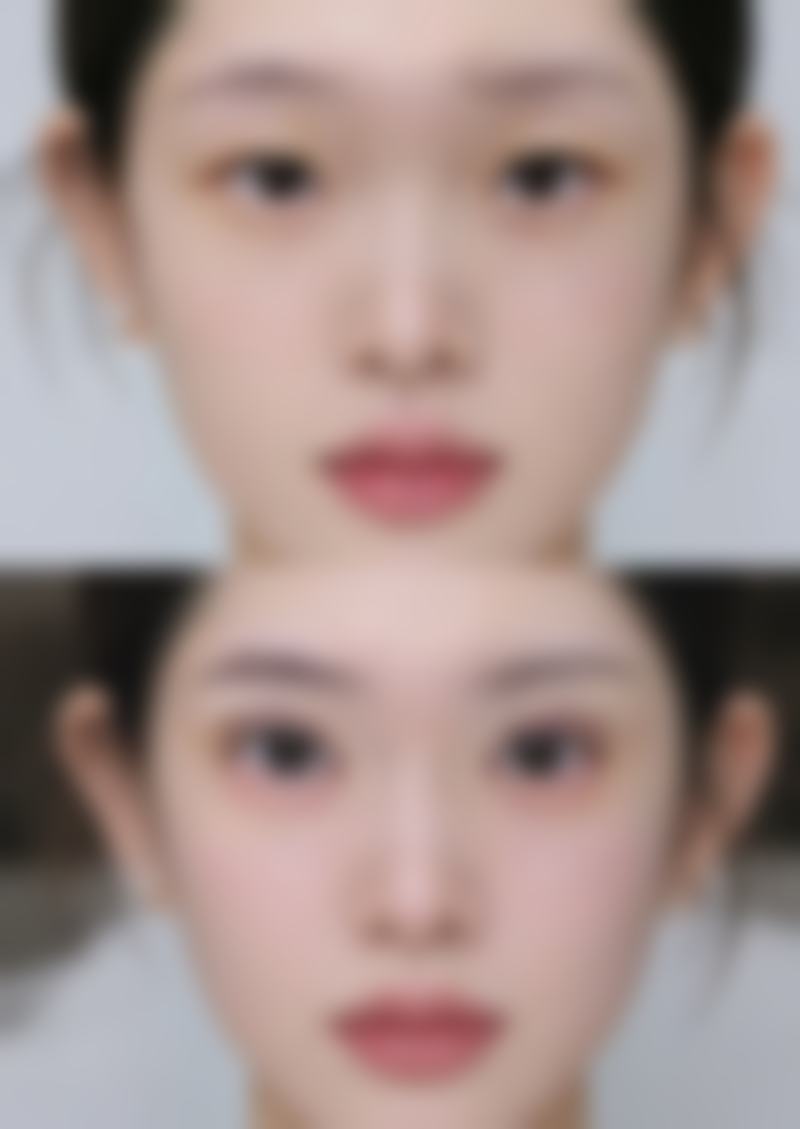 成都美呀皮肤整形医学美容诊所口碑评价怎么样？