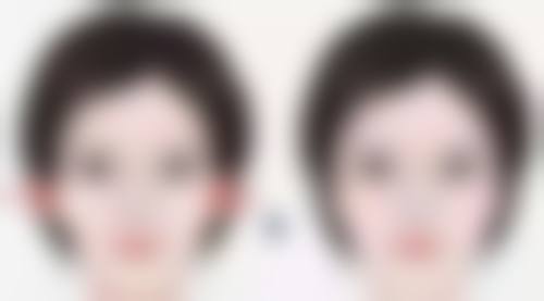 济南鹏爱美容整形医院正规吗?