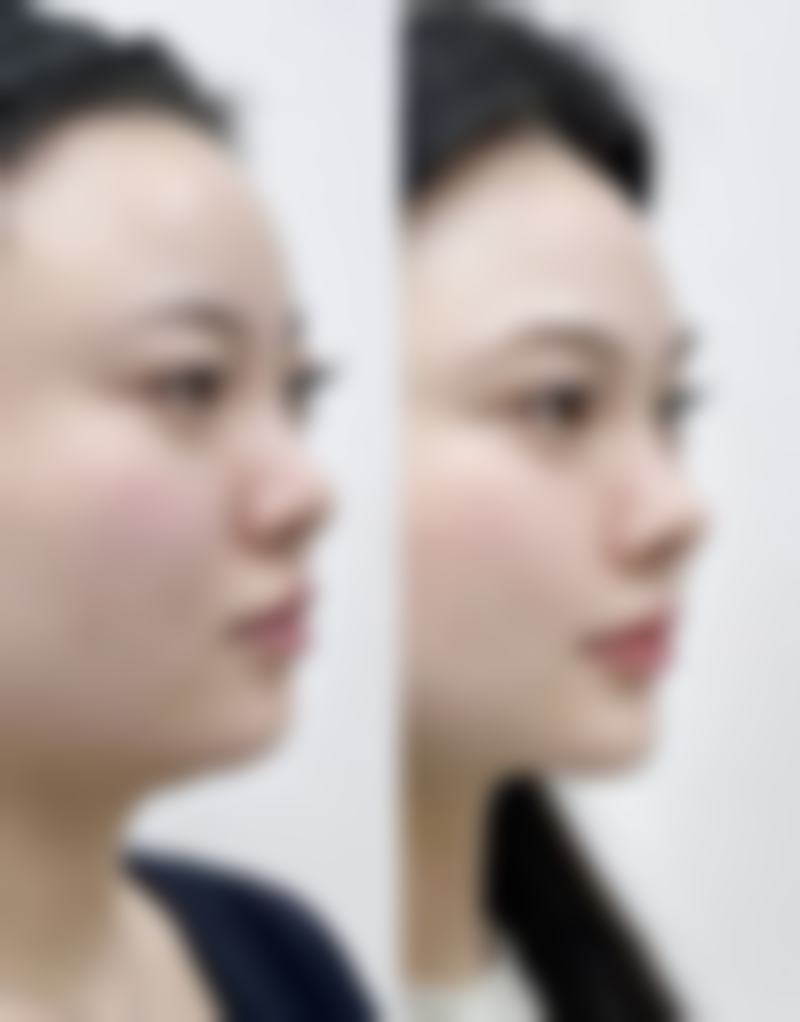 韩国beautyline整形医院怎么预约