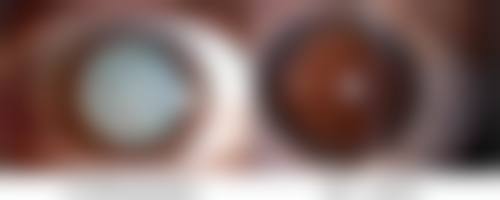 眼贴的适用与限制场景有哪些?