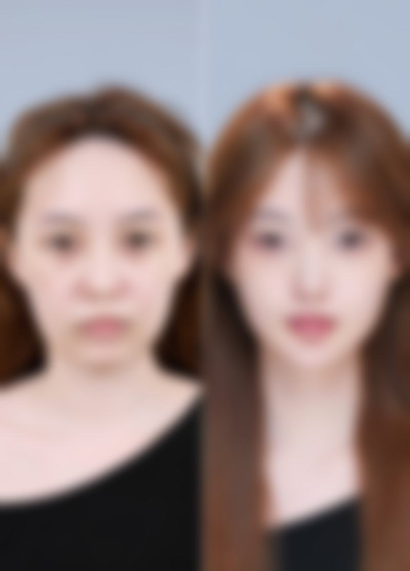 比丽普整形外科口碑评价怎么样?