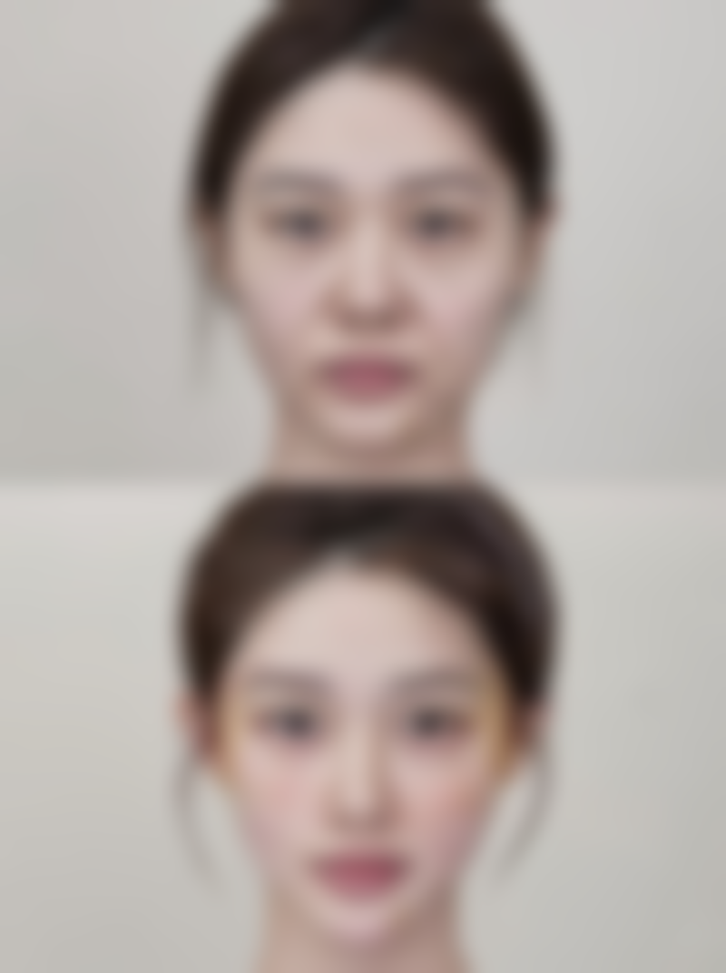 其他地区有优质的埋线双眼皮医生吗?