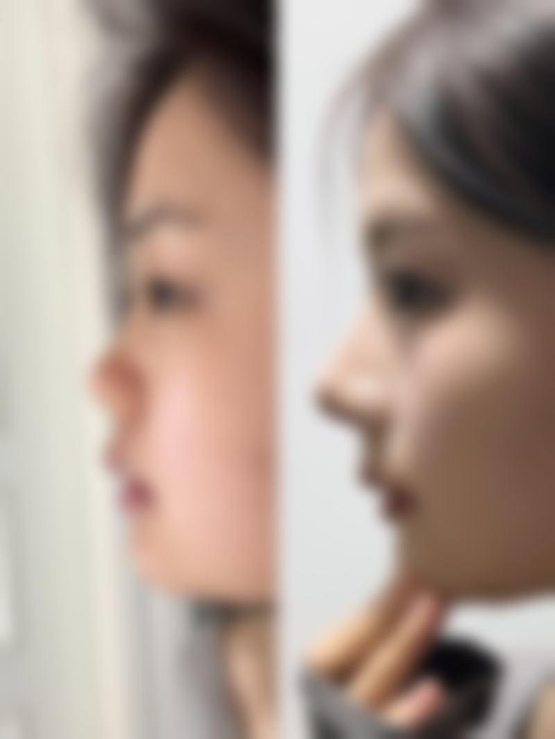 韩国Nature整形外科黄正勋医生预约挂号指南