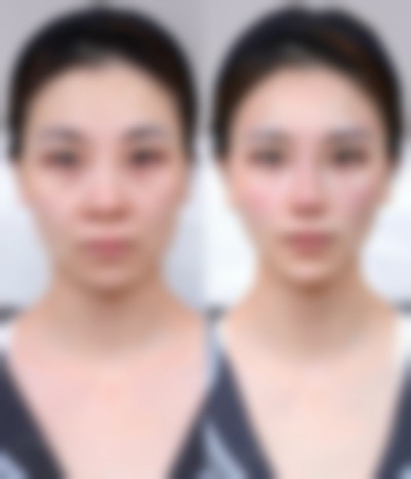武汉青春百年(岁)医疗美容医院口碑评价怎么样?