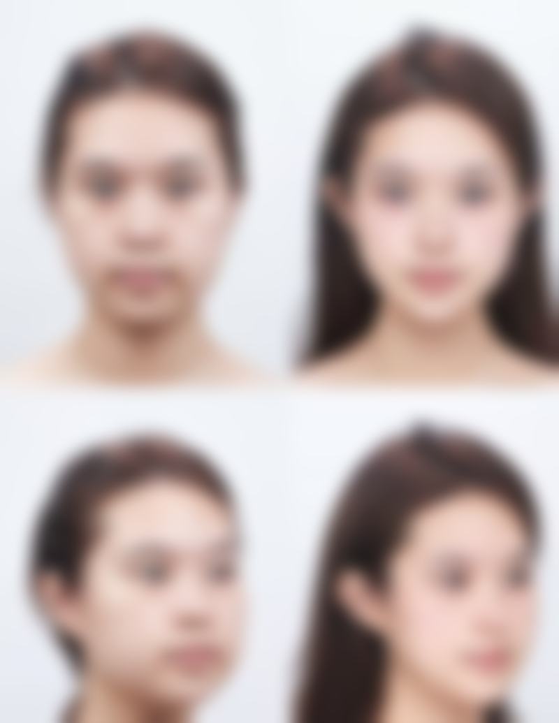 大连天俪医疗美容马越鹏医生眼部整形技术怎么样?