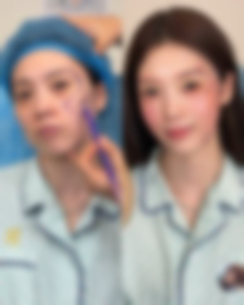 绵阳中 心医院医学美容科周竹梅医生重睑术技术怎么样?