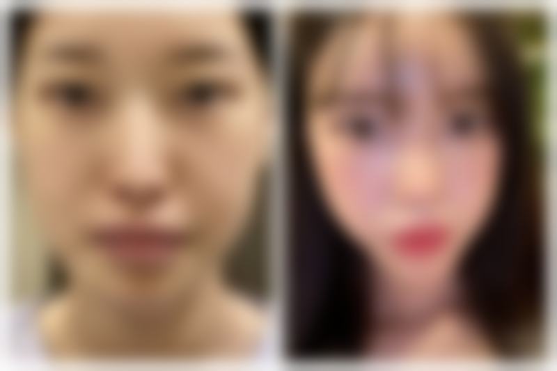 上海针美汇(欧邦)医疗美容门诊部口碑评价怎么样?