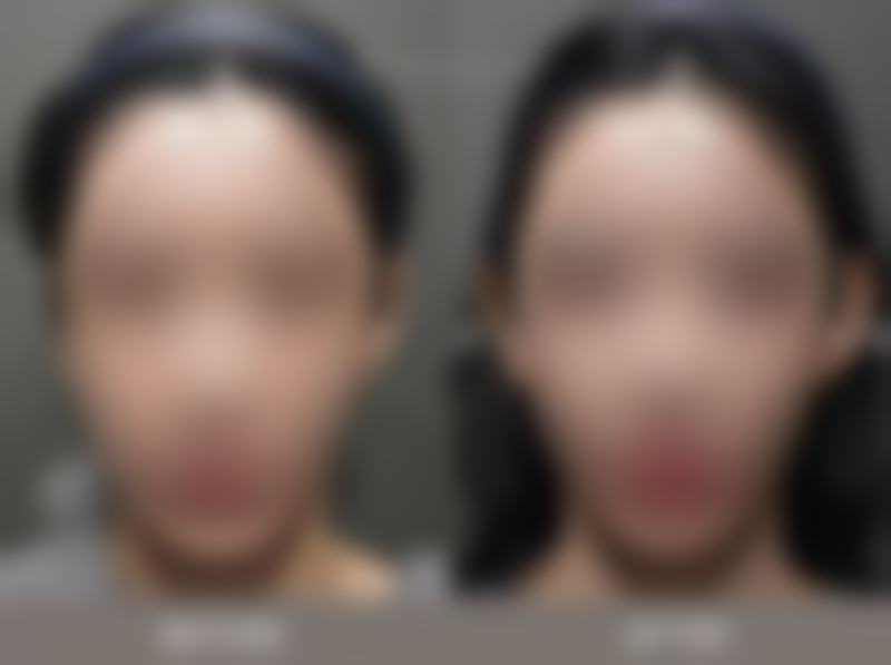 哈尔滨大美医疗美容门诊部怎么预约