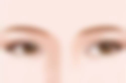 如何选择适合自己的双眼皮类型和手术方式呢?