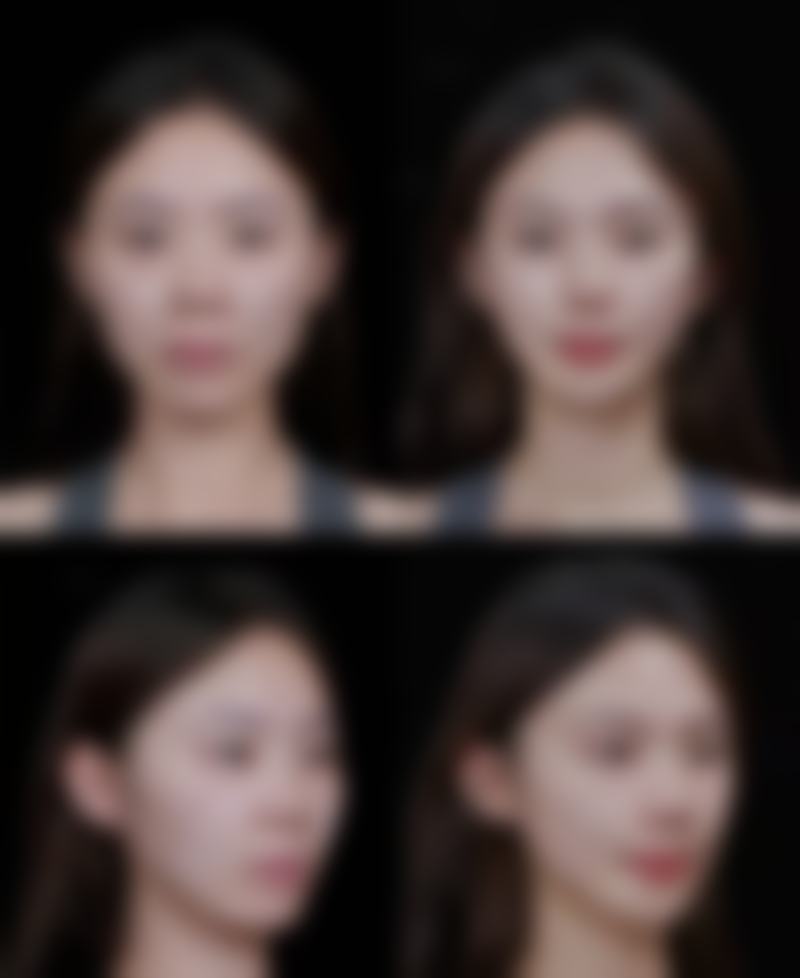 改善咀嚼习惯能瘦咬肌吗?