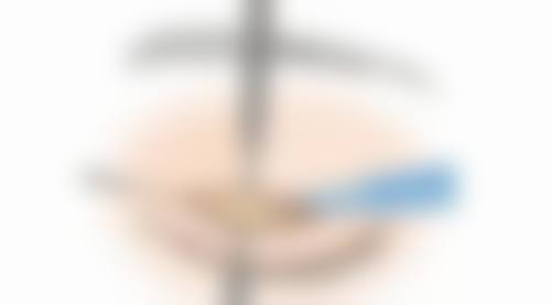 总结