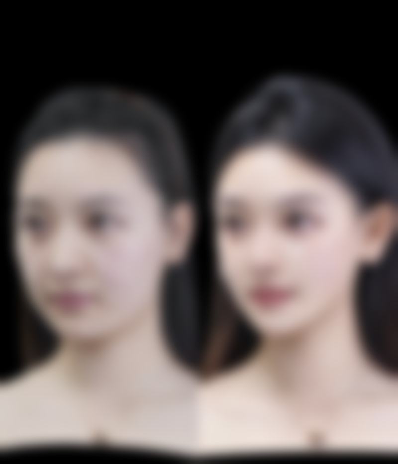 在去除一岁小孩脸上疤痕的过程中,就医和安心方面有哪些提示呢?