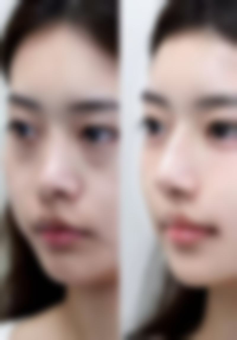 疤痕子宫月经淋漓不尽该吃什么食物来补血?