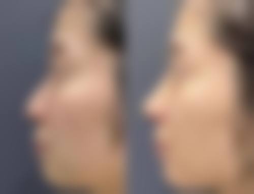 贵州省美容整形外科医院孙娜娜医生患者评价