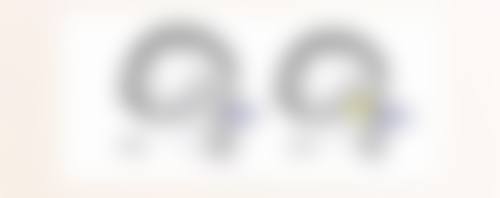 宽双眼皮修复的时机怎么选择？