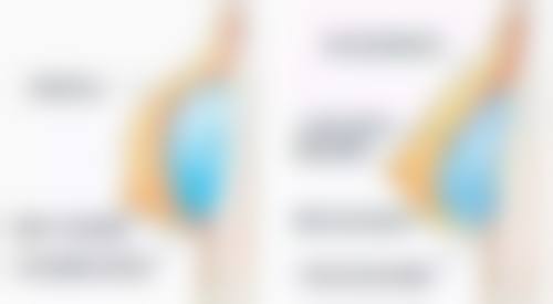 割双眼皮伤到神经能修复吗?