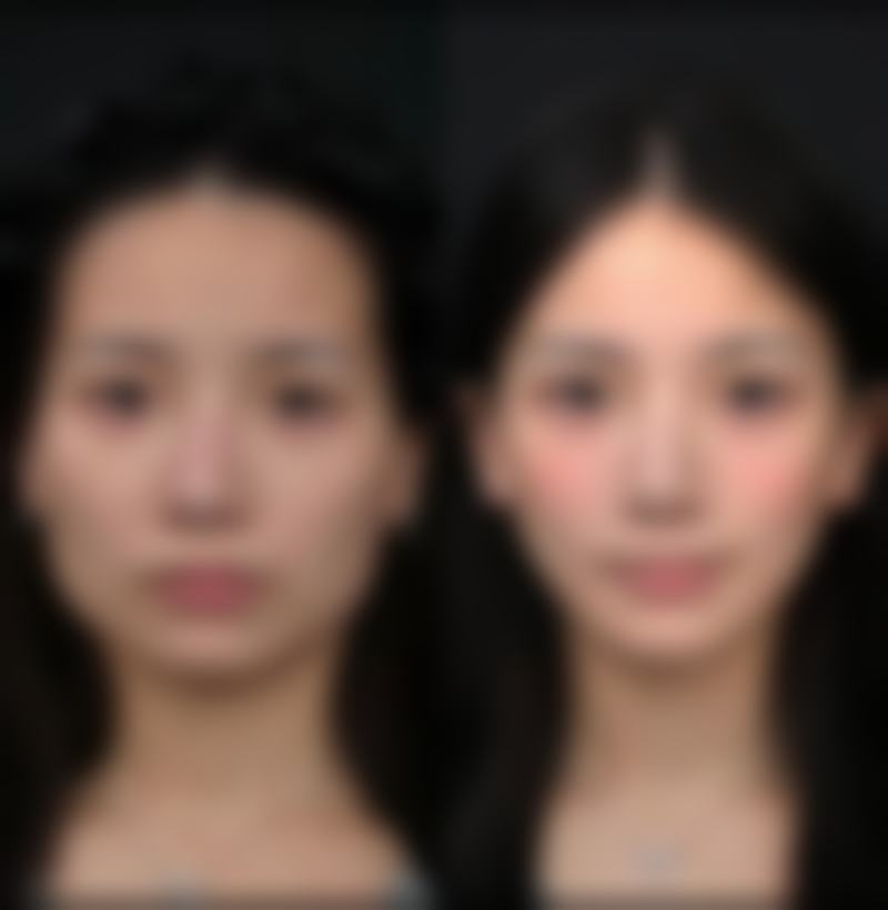 哪些因素会加重或延长神经修复时间?