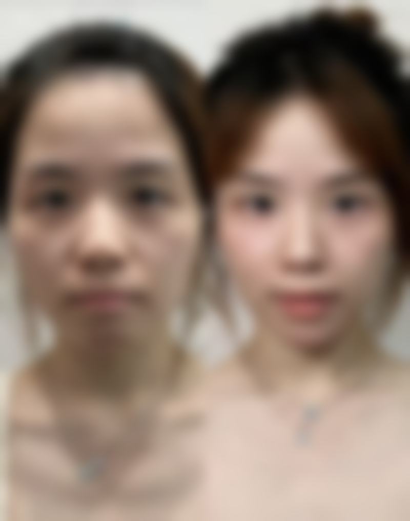 首都医 科 大学附属复兴医院整形外科高尚医生收费价格