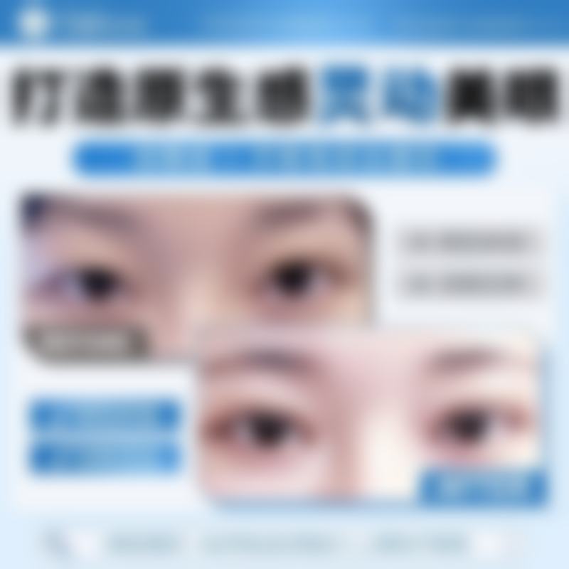 韩国TS整形医院李昇燦医生预约挂号注意事项