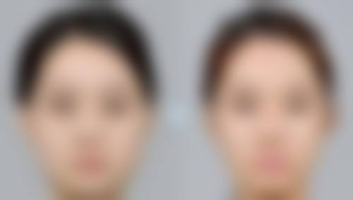韩国清潭茉莉花整形外科正规吗?
