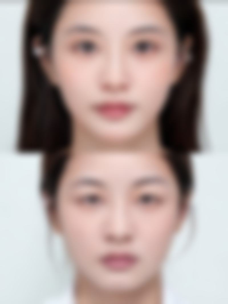 熬夜形成的眼袋如何消除？试试按摩、热敷，搭配眼霜和充足睡眠能否有效？ 