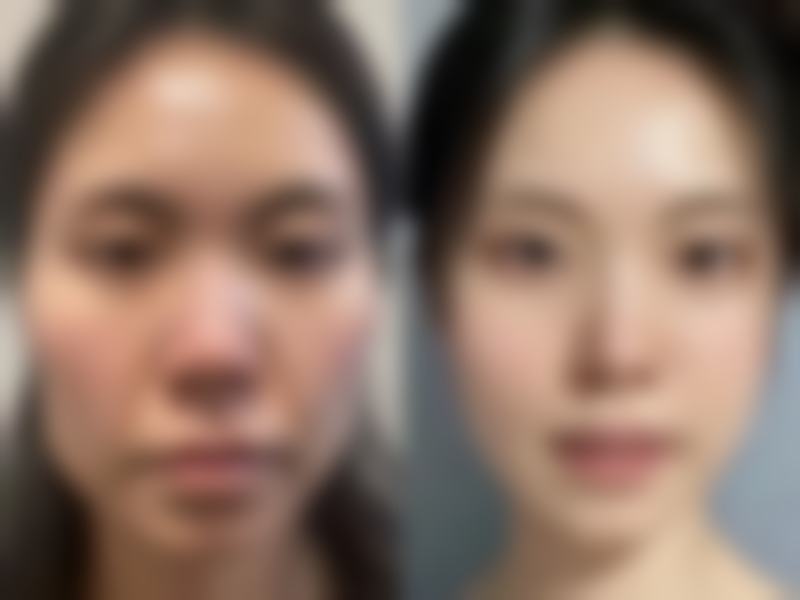 九江善善伊美整形医院收费价格表