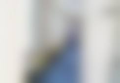 北京蜜邦医疗美容诊所马克伟医生脂肪填充技术怎么样？