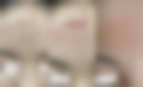 预约方式——快速到院变得更美
