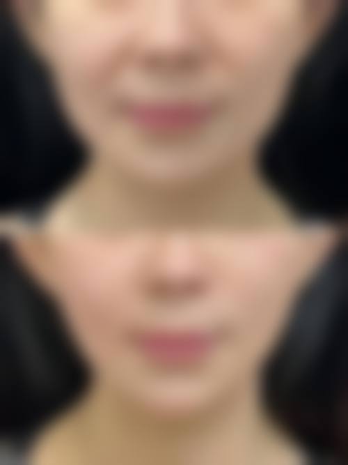 擅长项目详解