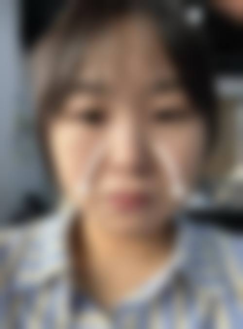 临床实例分享