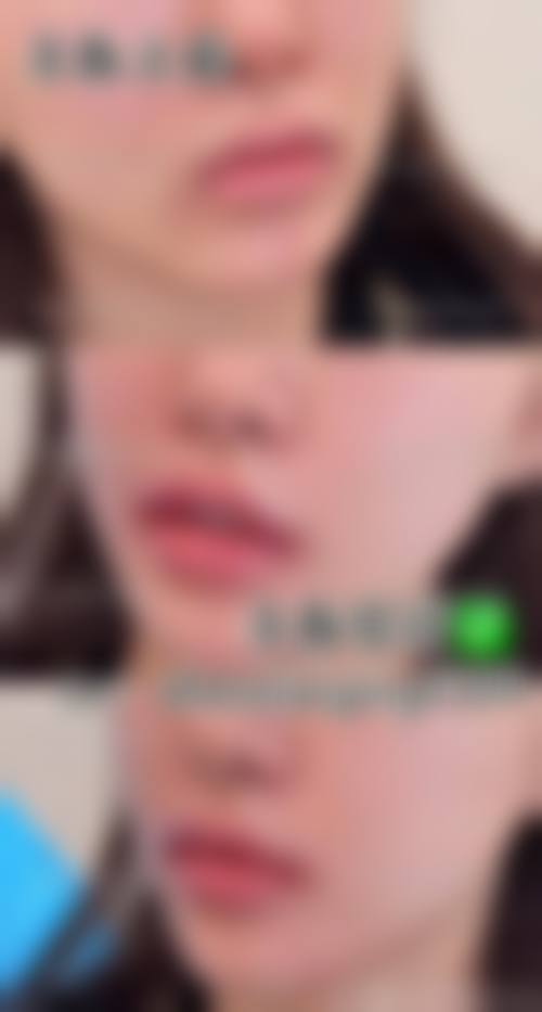 患者真实评价