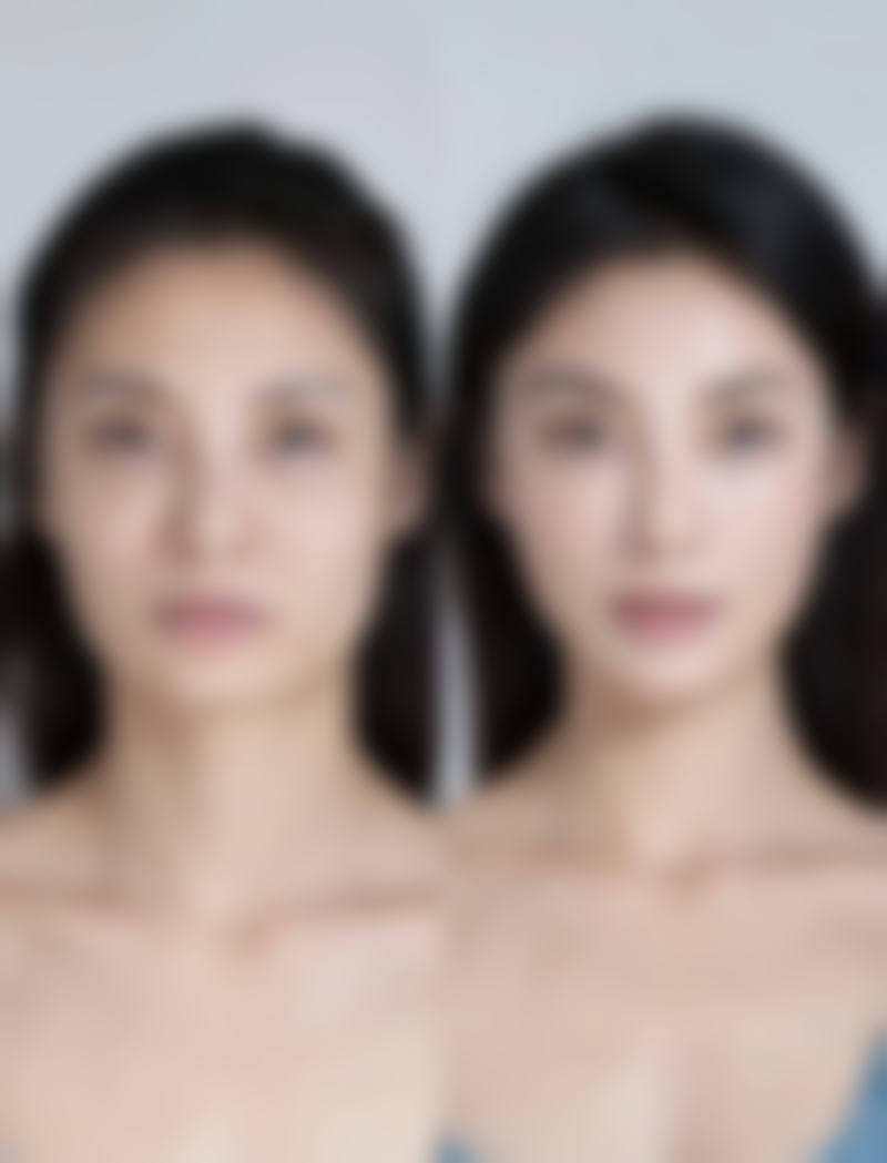 德州圣韩美医疗美容门诊部陈昌昕医生收费价格