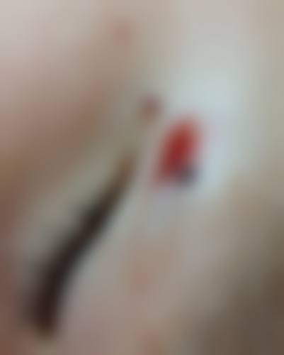 擅长项目详解
