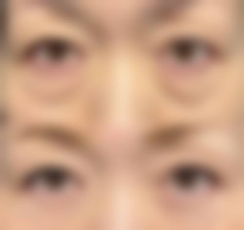 优惠活动详情:限时补贴,美丽不贵