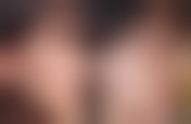 哪些因素会影响双眼皮手术的修复时间?