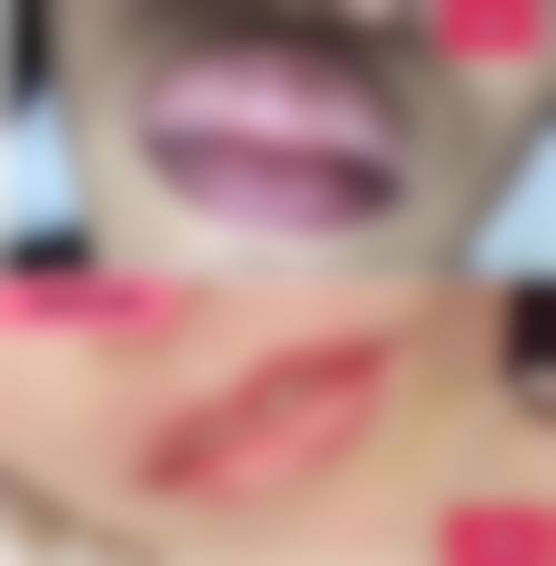 永城华美医疗美容门诊部赵付彬医生擅长项目
