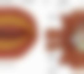设备环境介绍:准分子激光与精细检测设备