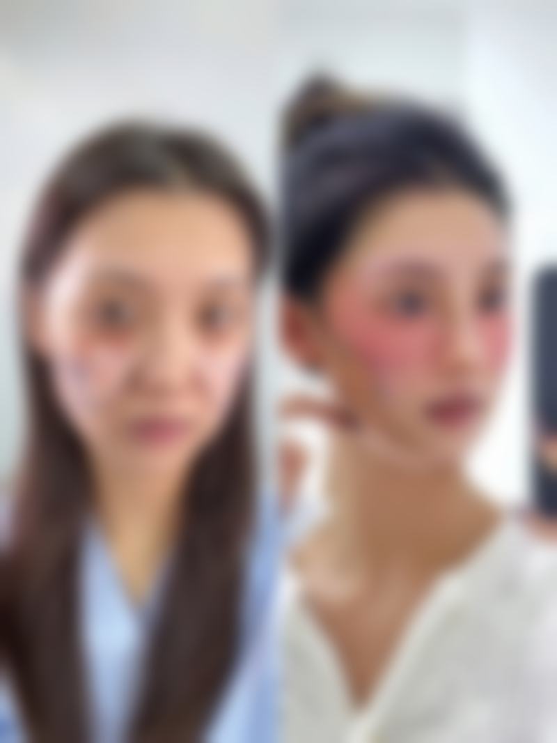郑州星艾雅医疗美容王益粉医生皮肤美容技术怎么样？