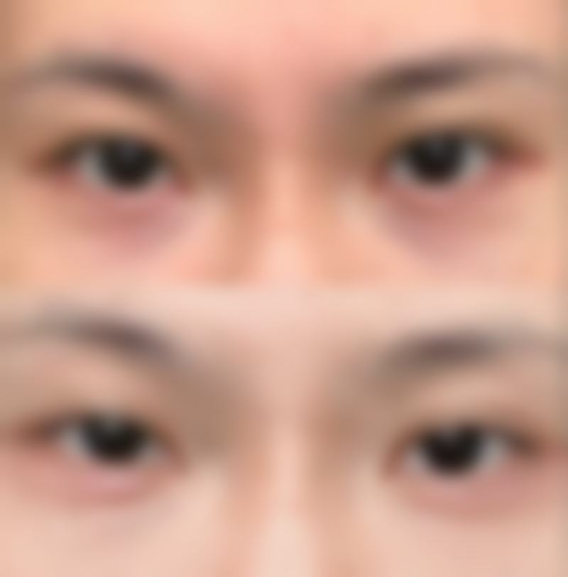 武汉明亮整形医院陈明亮医生擅长项目