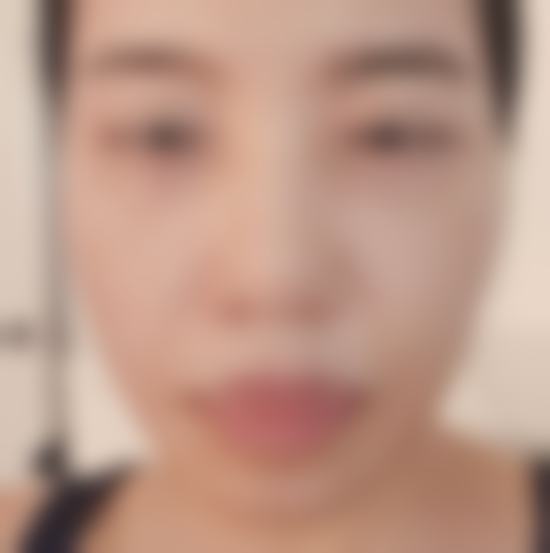 揭秘韩国TS整形医院吕贤东技术特点，精准细腻、创新高效铸就卓越整形效果！ 