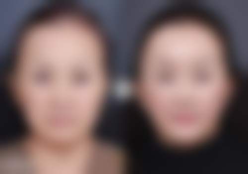 乌海语遥诚美(原雅美)医疗美容门诊部收费价格表