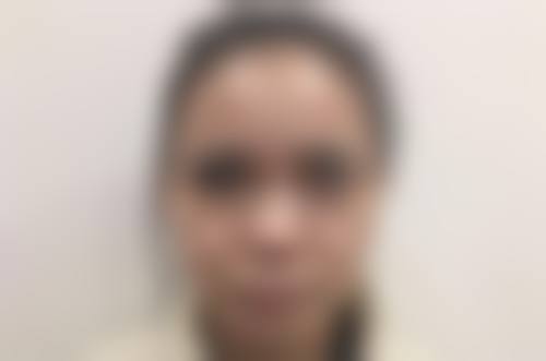 无锡第三人民医院烧伤整形科赵庆国医生患者评价