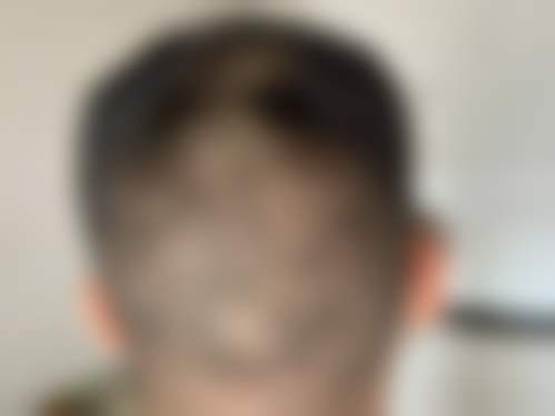 盐城东方女子医院整形科马琳娜医生面部轮廓技术怎么样?