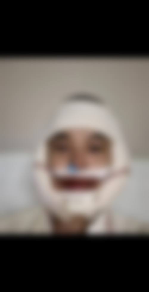 擅长项目详解——彭丽霞医生擅长项目详解(面部轮廓整形)