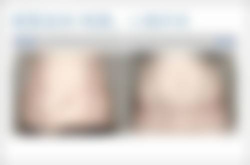 北京美丽说医疗美容诊所正规吗?