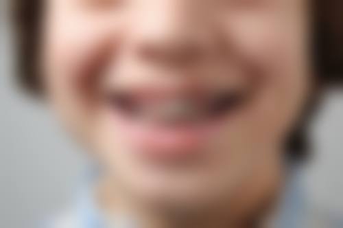 优惠活动详情：实惠看牙，超值体验
