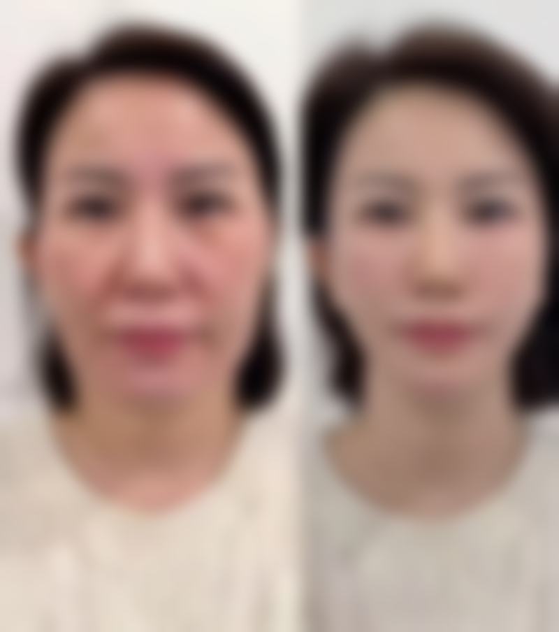 日常需要注意什么？