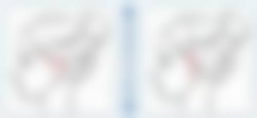 什么情况下可以考虑单眼手术呢?