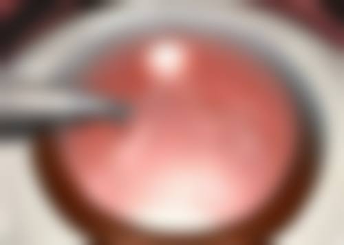 患者真实评价:找陈宝兴医生看眼病的人怎么说?